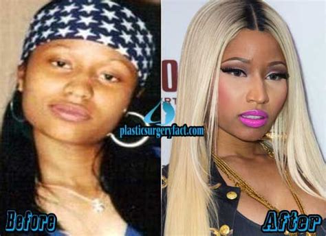 Nicki Minaj has mid